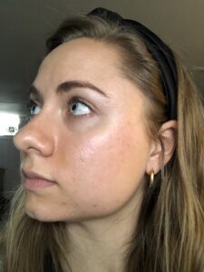 Mikaela Lauren Wellness Skin Journey 2020 Clear